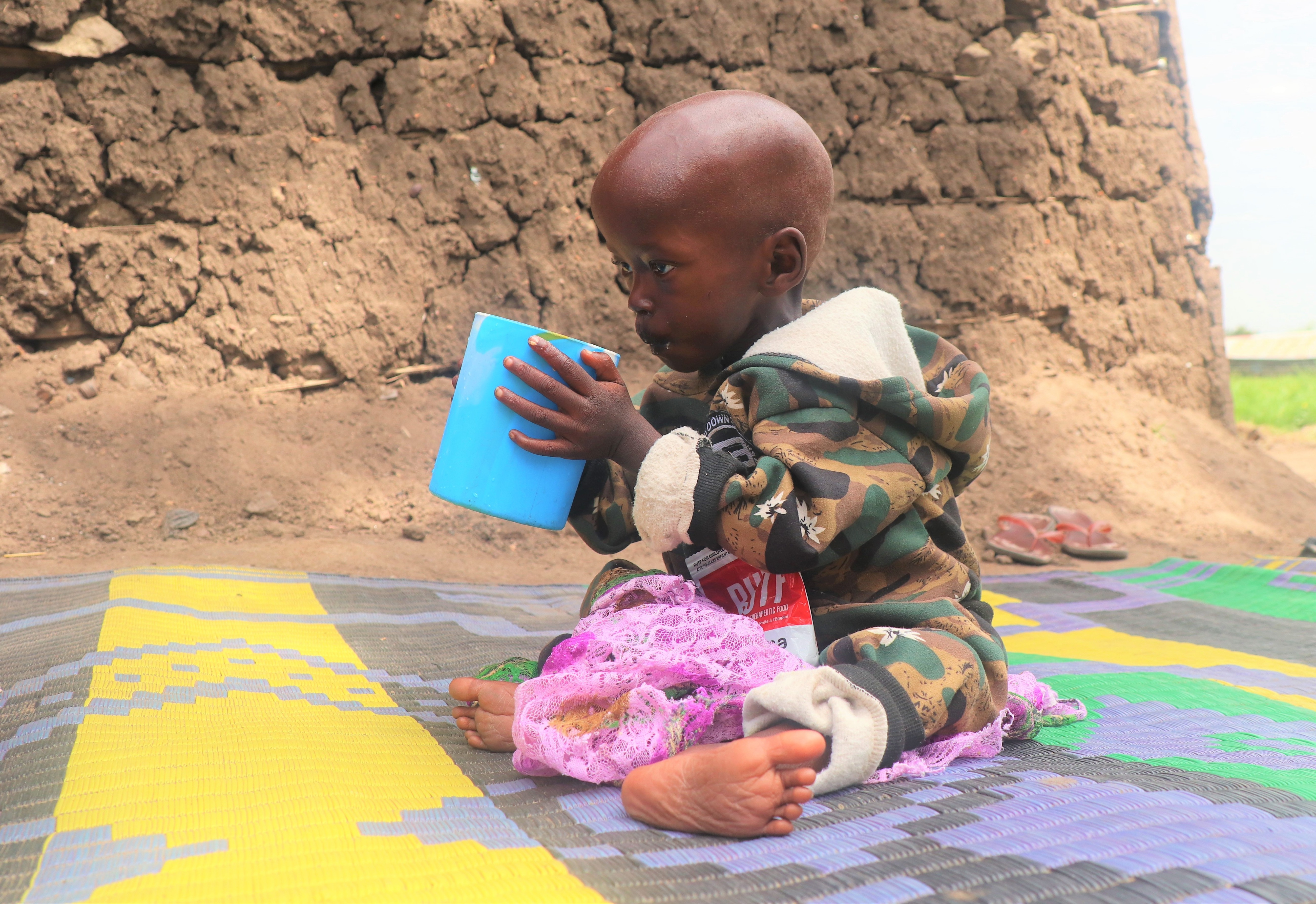 For almost a year now, Ocan’s only survival depends on the RUTF and water which gives him energy, his mother says. 