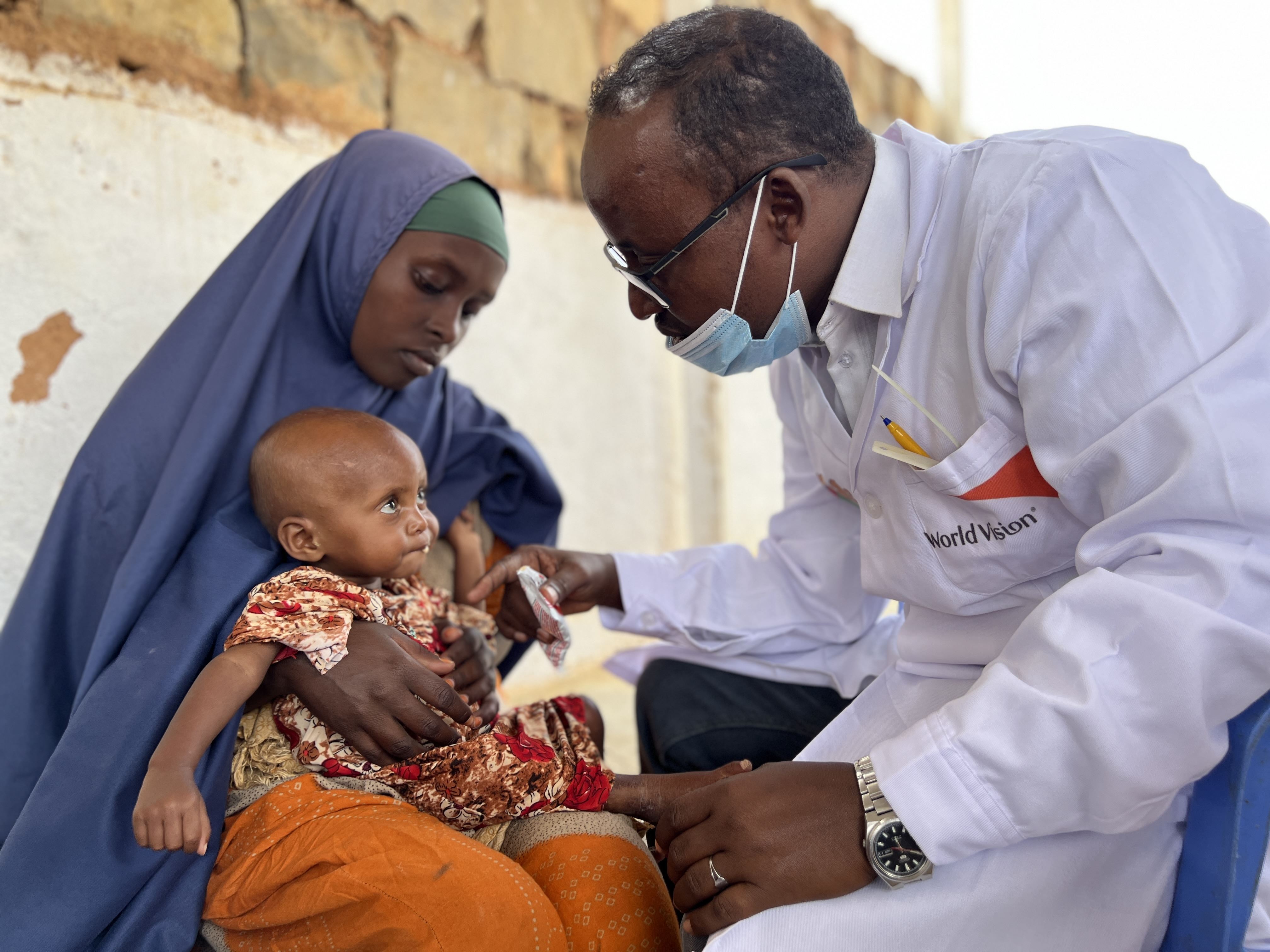 World Vision staff member is treating malnourished 12-month-old baby while her mother holds her.