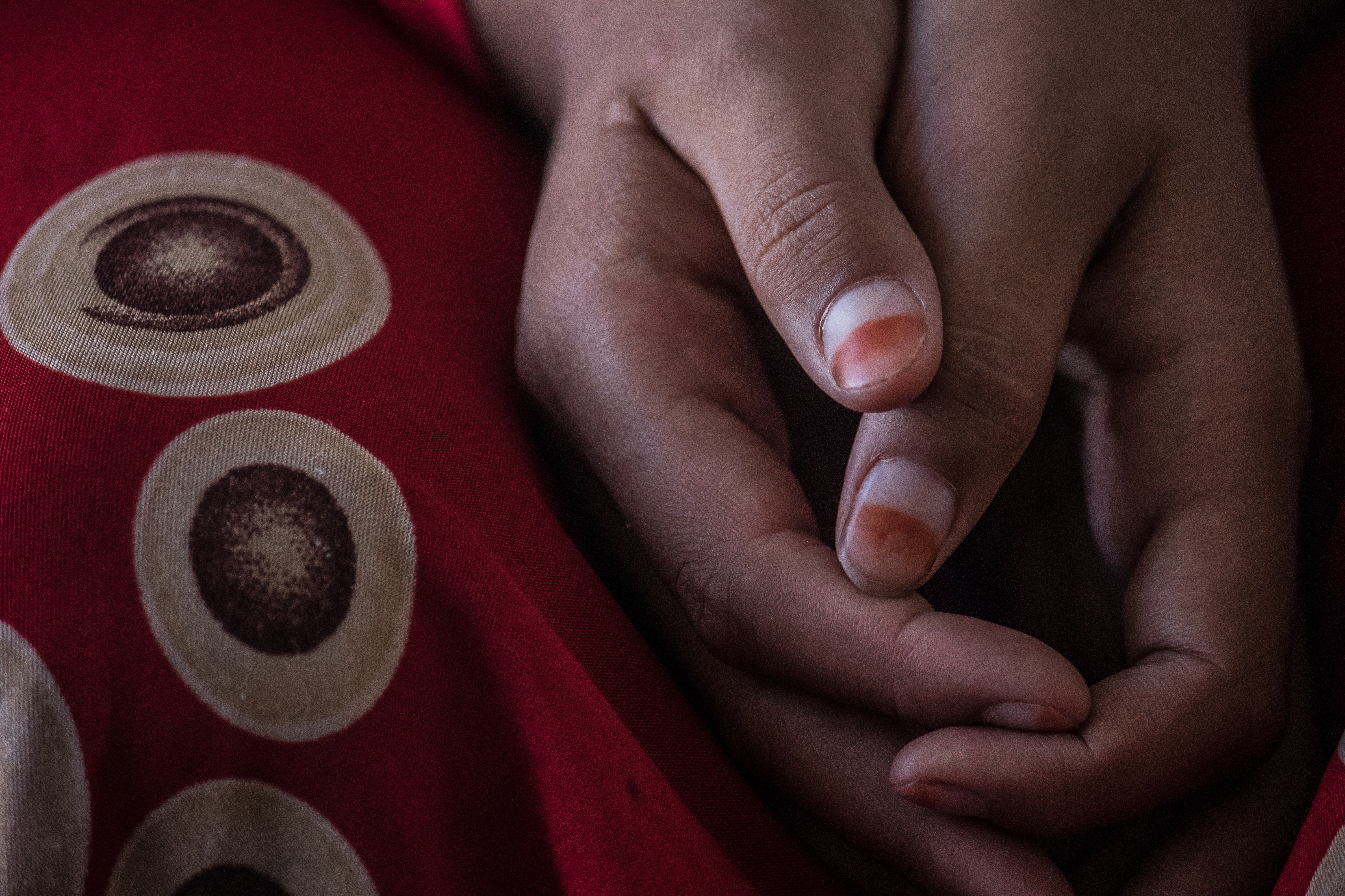 Hands of a girl in Iraq, whose face isn't pictured as she talks about being forced into child marriage