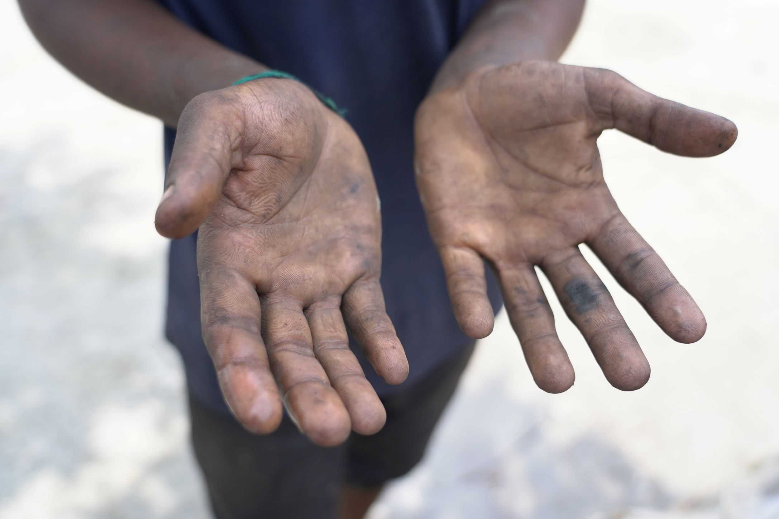 Dirty hands of a child labourer, palms facing upwards